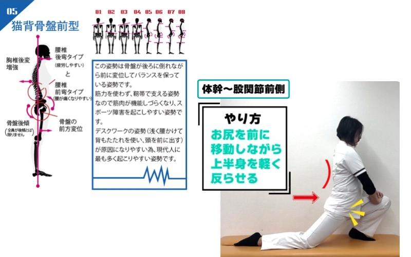 AI姿勢分析による⾃宅でのセルフケア